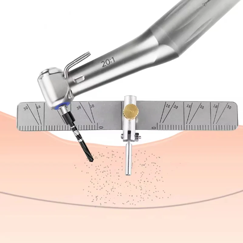 Przewodnik po lokalizowaniu implantów dentystycznych Lokalizator sadzenia chirurgicznego Linijka kątowa Licznik Autoklawowalne produkty do renowacji zębów