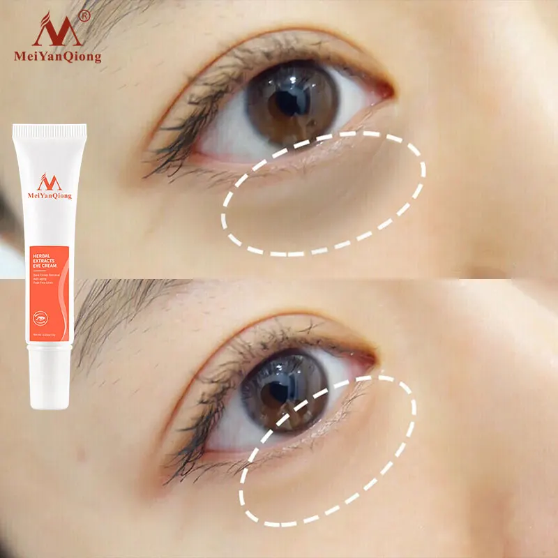 

MYQ Herbal Eye Cream Anti-Aging Anti-Puffiness Dark Circles Removal Fade Fine Lines smooth eye area firm skin Eye care Eye cream