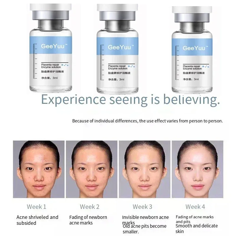 Polypeptide Placenta Freeze-dried Powder Essence Repair Facial Hydrating Nourishing Pore Shrinking Skin Rejuvenate Skin Care