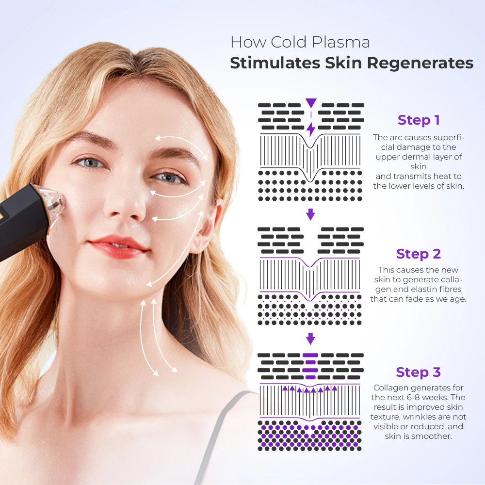 โลก # ปากกาพลาสมาเย็นสำหรับยกกระชับใบหน้าและลำคอ 1 เครื่อง สำหรับใช้ในร้านเสริมสวย/คลินิก ยี่ห้อ Leaflife อุปกรณ์ความงามนวัตกรรมใหม่สำหรับใช้ในบ้าน ช่วยลดเลือนริ้วรอย