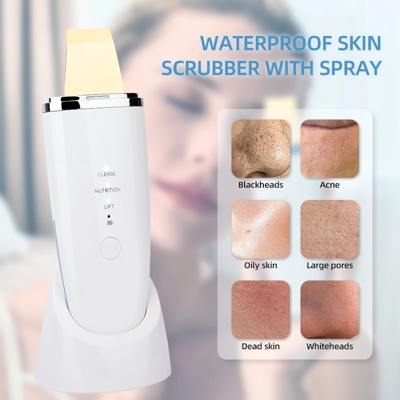 Ultrasoon gezichtsreinigingsapparaat - Zeer nauwkeurig diep reinigend hulpmiddel voor het exfoliëren van acne en het ontstoppen van poriën