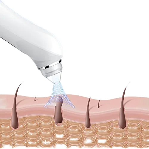 スマートライブラリWiFiビジュアルフェイシャルポアクリーナー5MP 20倍拡大ブラックヘッドリムーバー真空フェイシャルクリーナー