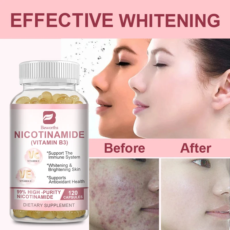 BEWORTHS Nicotinamide Brighten Skin NAD Supplement Helps Skin Health Metabolism Cell Regeneration Immunity Healthy Food