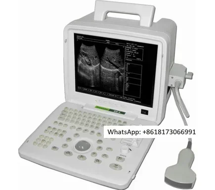 Portable B-ultrasound machine for human use. B-ultrasound machine Mindray DP-10, same model as outpatient standard with SS6