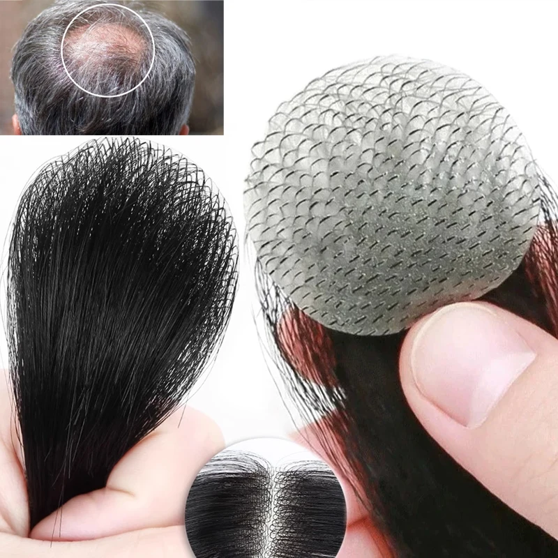 Parche para cicatrices de postizo superior de la cabeza, peluquín de cabello humano 100%, parche de cicatriz Circular Invisible sin costuras de piel ultrafina de PU para hombres