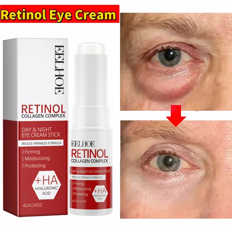 

Instant Eye Bag Remove Eye Cream Anti Fat Particles Dark Circles Puffiness Fade Fine Lines Lift Brighten Korean Beauty Eye Care