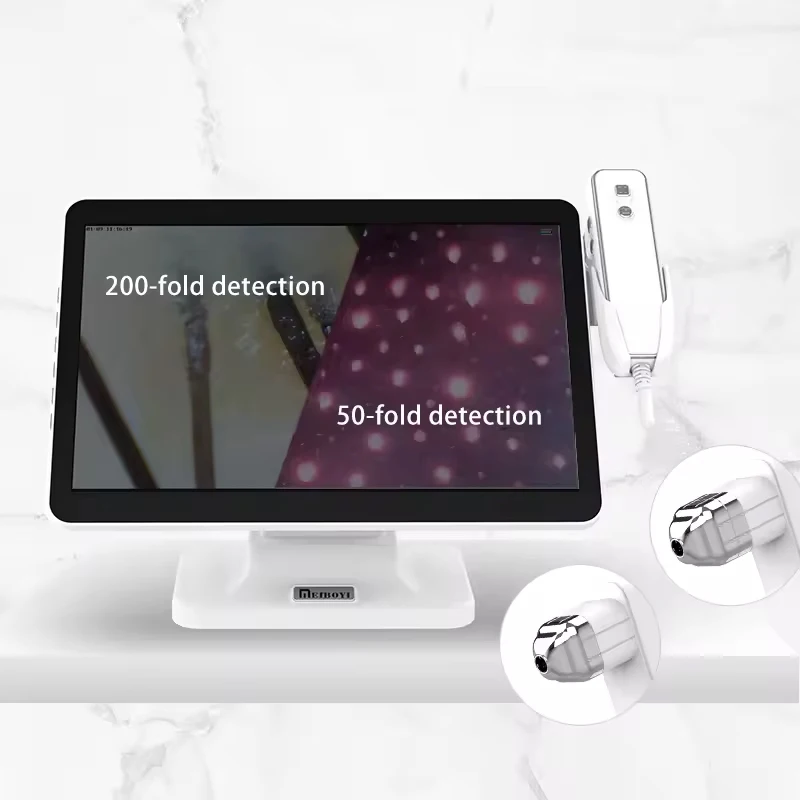 Hair Scalp Skin Analyzer Hair Follicle Detector Scalp Microscope 4 Spectral 5G WIFI Hair Scanner Diagnostic APP Customer Archive