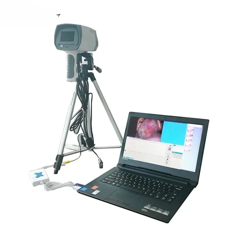 OEM Digital Colposcope  for Early Cervical Cancer Detection