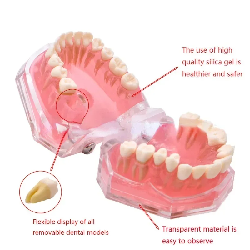 Dental Teaching Model Teeth Dental Soft Support Standard Extractable Tooth Stomatology Typodont Model 1:1 Demo Gum Jaw Removable