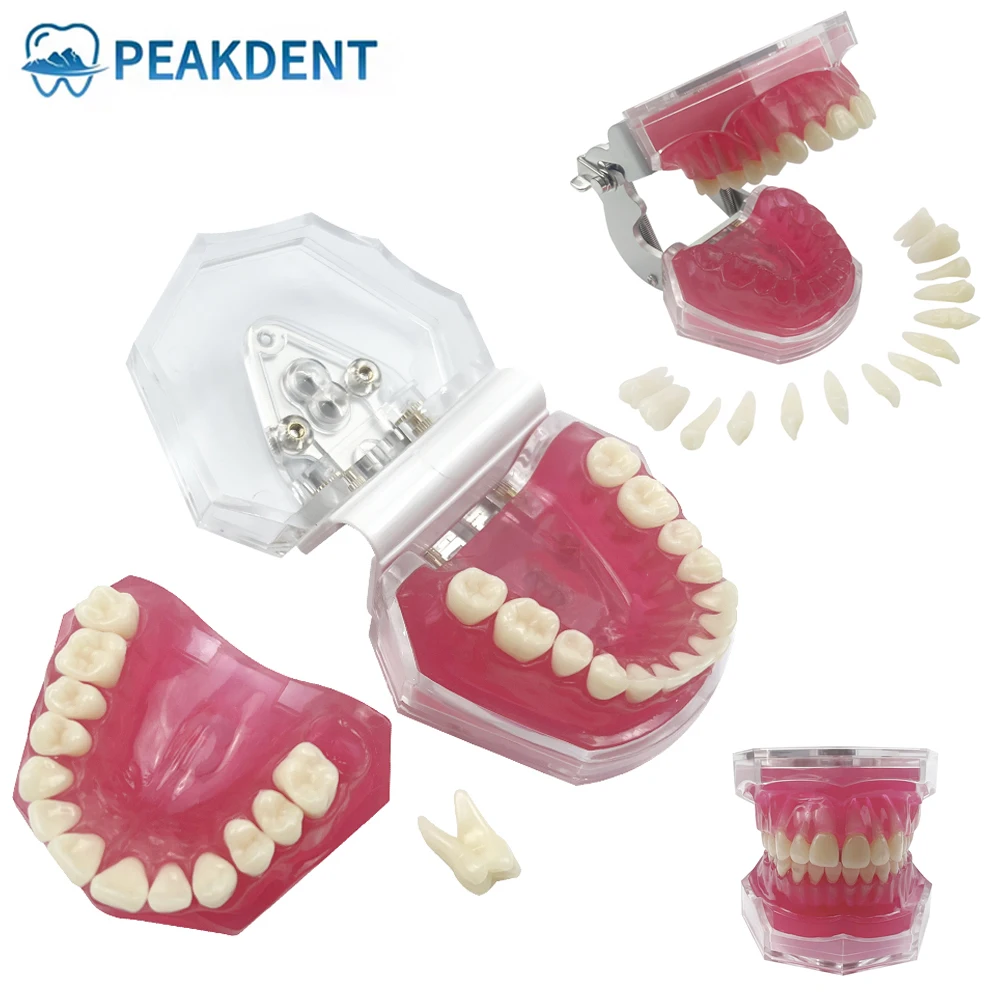 

Transparent Dental Model With Removable Teeth Soft Gum Tooth Extraction Pratice Models For Patient Education Extraction Demo