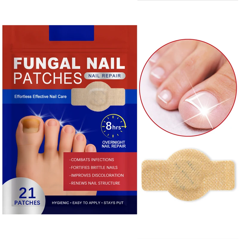 21 pieces of onychomycosis stickers waterproof nail repair stickers nail ingrown nail correction stickers foot care tools