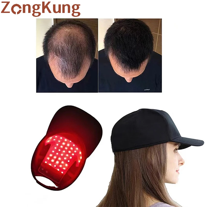 

LED Red and Blue Light Physical Therapy Cap Promote Hair Growth Cap Infrared Light Therapy for Hair Loss USB Rechargeable Model