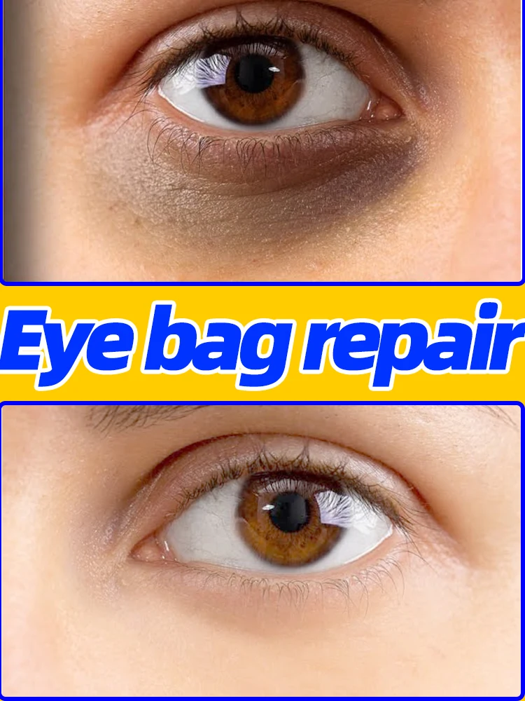 Bolsas para ojos en crema para ojos