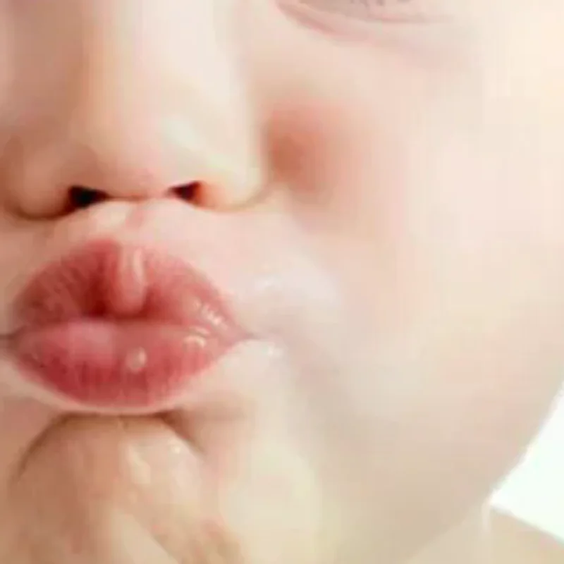 

8Pcs Ear Corrector Tape Ear Corrector Fixer Cosmetic Ear Stickers Like Elf Ears Stretched Ears Ear Corrector Tool