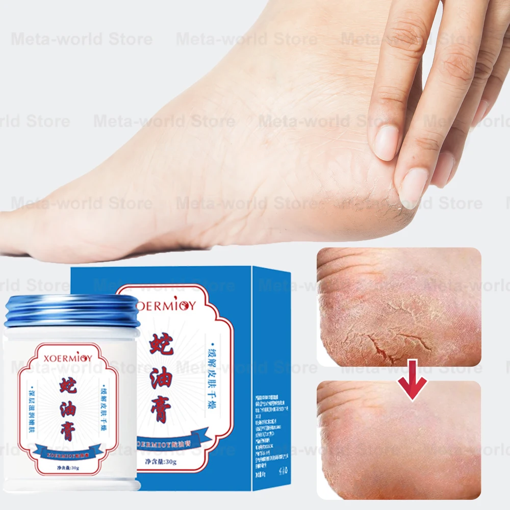 Herbal Foot Cream for Crack Heel Cracking Repair Cream Exfoliation Dead Skin Removal Foot Softening Moisturize Smooth Skin Care