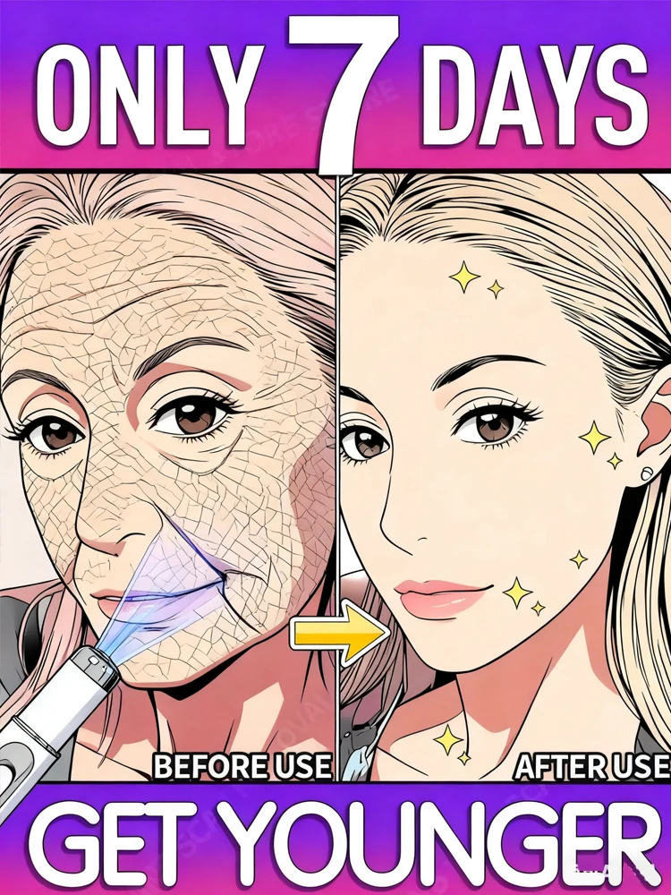 قلم الضوء الأزرق الأكثر مبيعًا لحل تجاعيد الوجه، أداة العناية بالتجاعيد