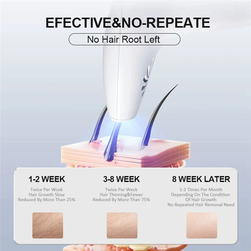 A15Q-Portable Hair Removal For Women Painless Hair Removal For Whole Body, Home Hair Removal Device EU Plug