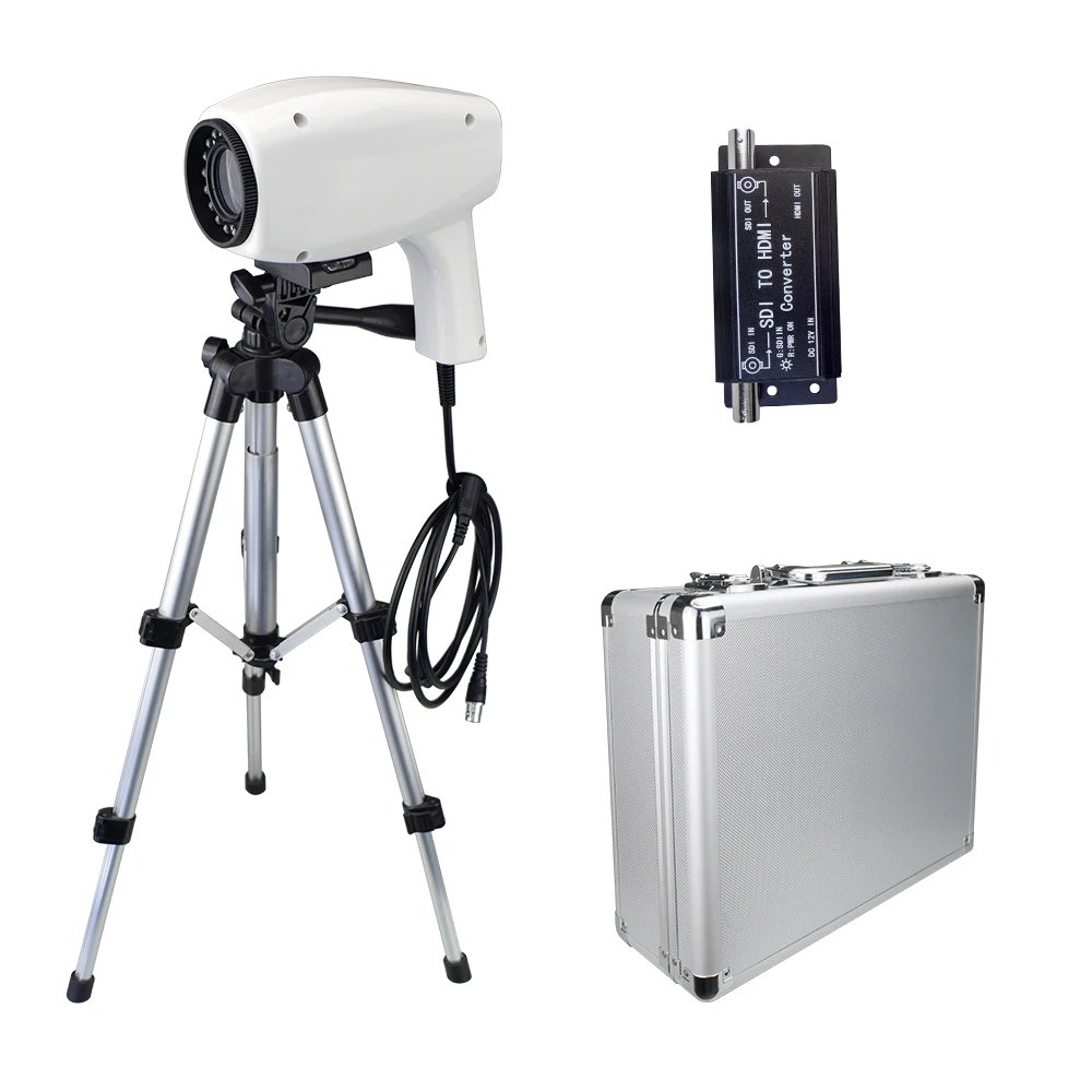 

LN-33XYDJ Gynecology Digital Video Colpos-cope Handheld Electronic Digital Colpos-cope With SDI/CVBS Output