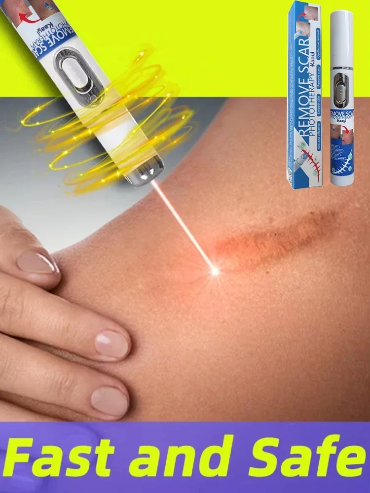 

Laser therapy Keloid scar| | Pen for scars | Safe and Efficient