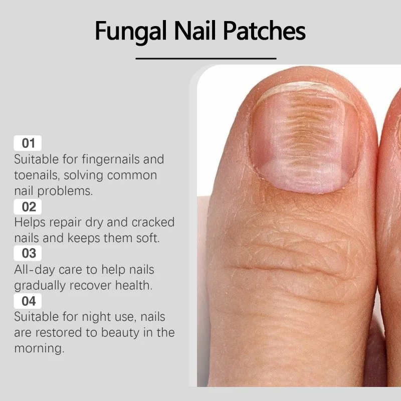 Patch de réparation des ongles, brillant naturel, imperméable, traitement Paronychia, correcteur de récupération, outil de pédicure, Patch de soins pratique, 32 pièces