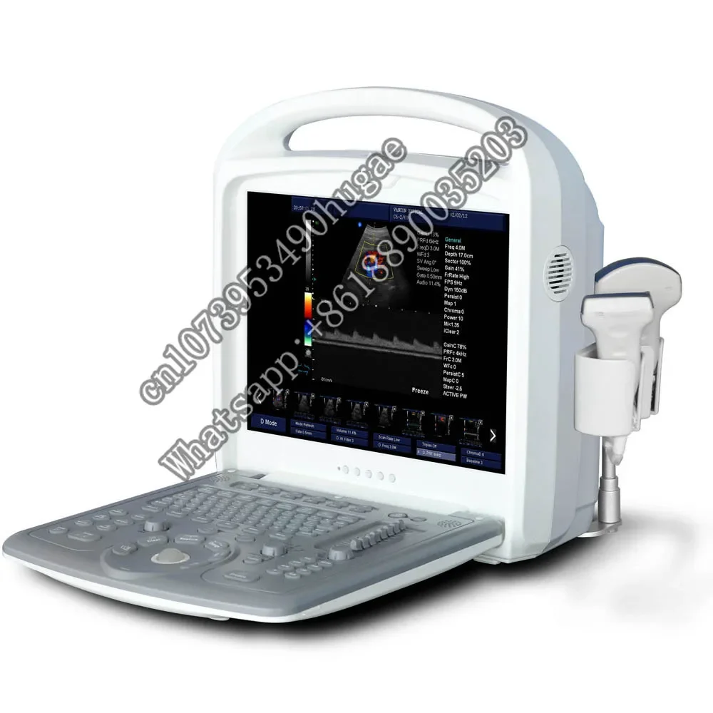 SZMIQU Ecography Echo Doppler Ultrasound & 3d Gynecologic preg--nancy s Product Portable Medical  Instruments