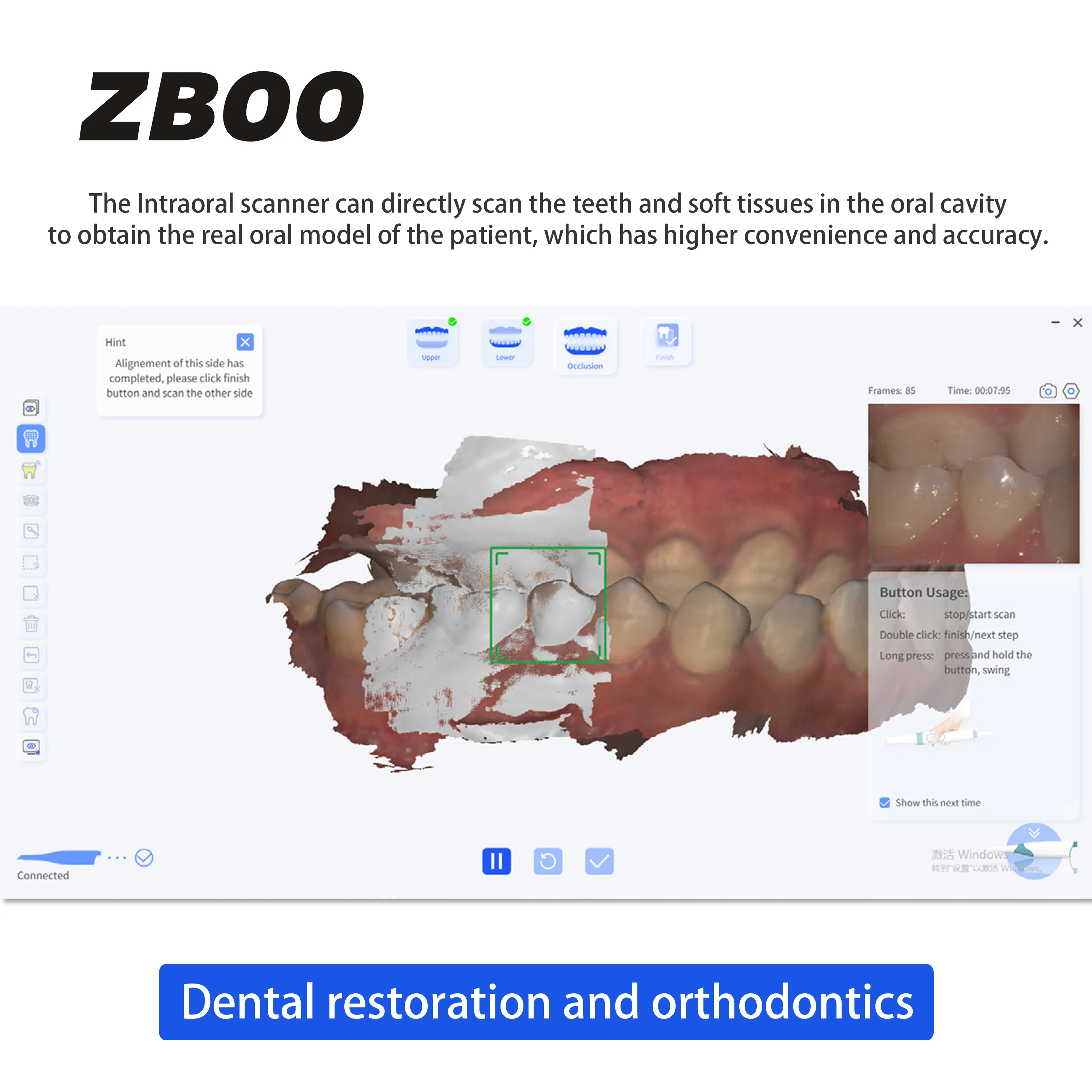 Tandheelkundige intraorale scanner 3D voor tandheelkundige restauratie Orthodontie Kroonimplantaat Tandheelkundige apparatuur