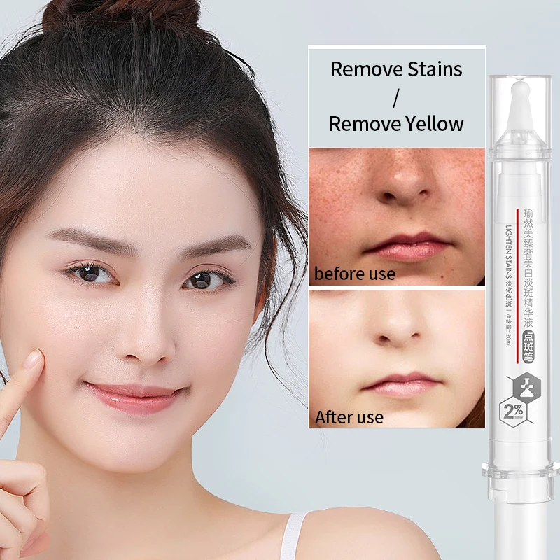 Yuranm Whitening Spot Serum To Remove Stubborn Spots, Freckles, Chloasma, Age Spots, Moisturizing, Niacinamide Spot Spot Pen