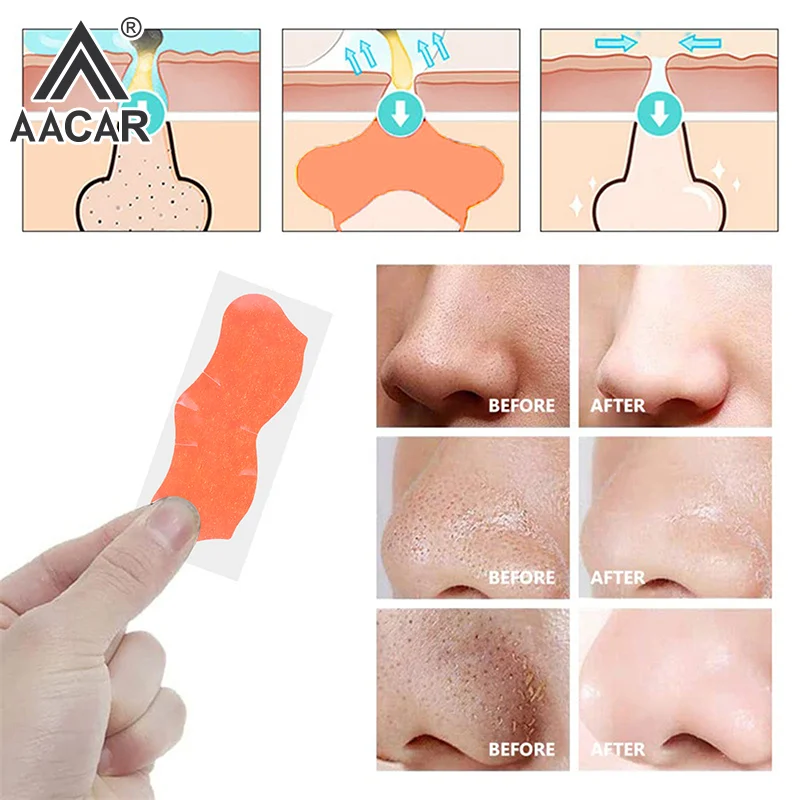 10/20/50 Stuks Mee-eter Verwijderen Neusstrip Acne Krachtige Adsorptie Mijt Remover Diepe Reiniging Krimpen Glad huidverzorging Masker
