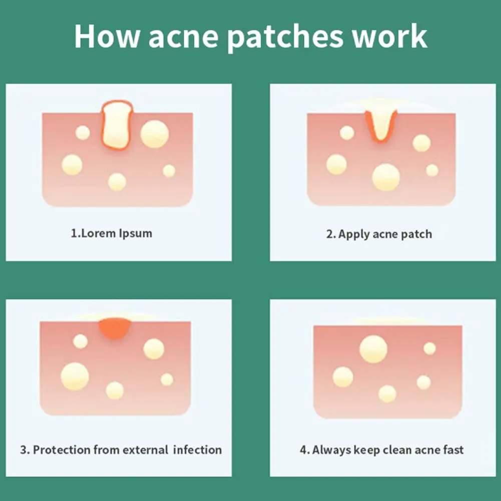 Onzichtbare Acne Patch 36 Tabletten Puistje Verwijderaar Stickers Huid Gezichtsverzorging Behandeling Model 2 Tool Beauty B7g4