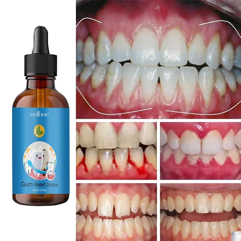 24 Relieve Tooth Damage Drops Rapid Repair Gums Serum Effectively Relieve Tooth Allergy Dental Caries Tooth Cleaning Toothpaste