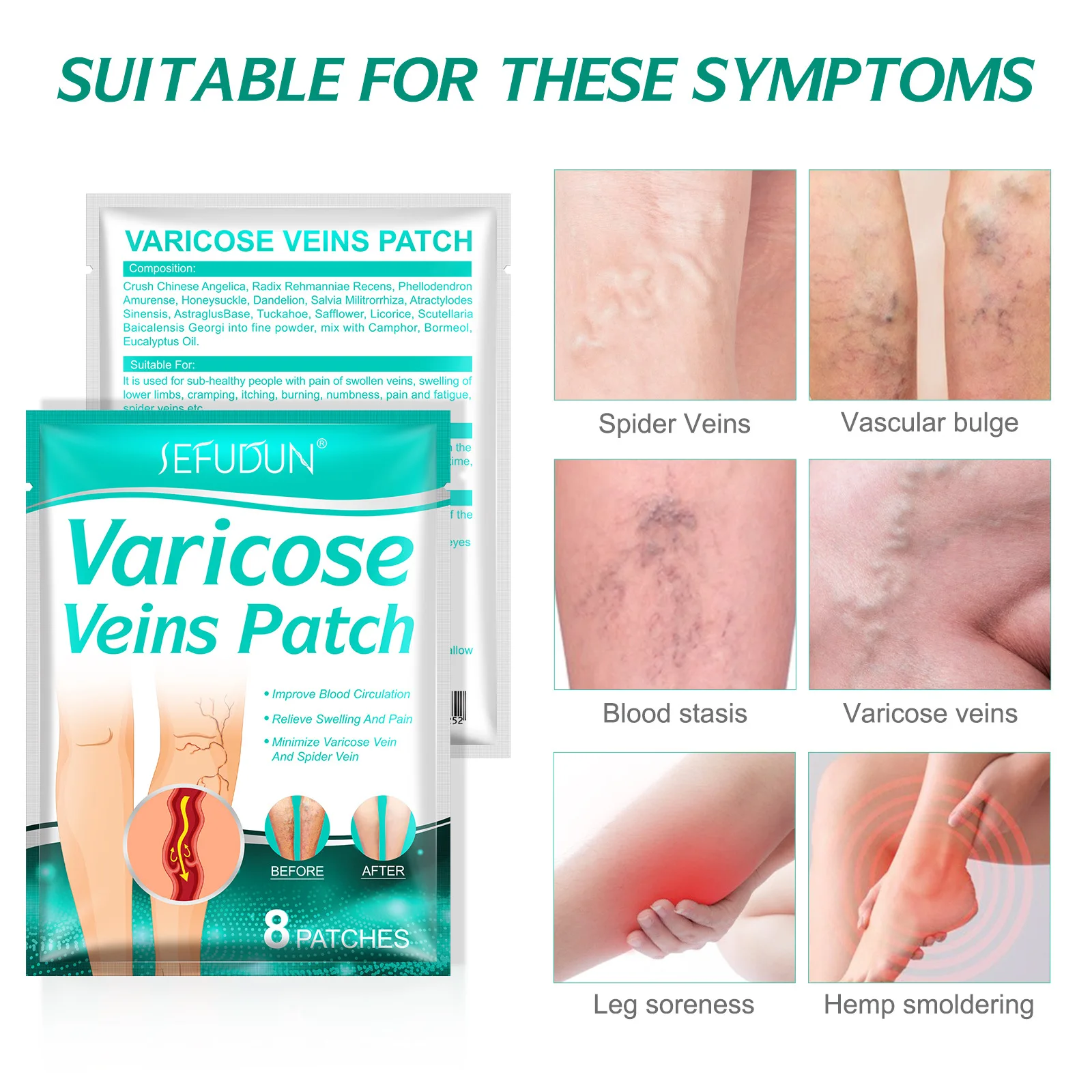 Patch de traitement des varices, plâtre pour les maux de jambes, favorise le métabolisme, favorise la Circulation sanguine lisse, 8 pièces