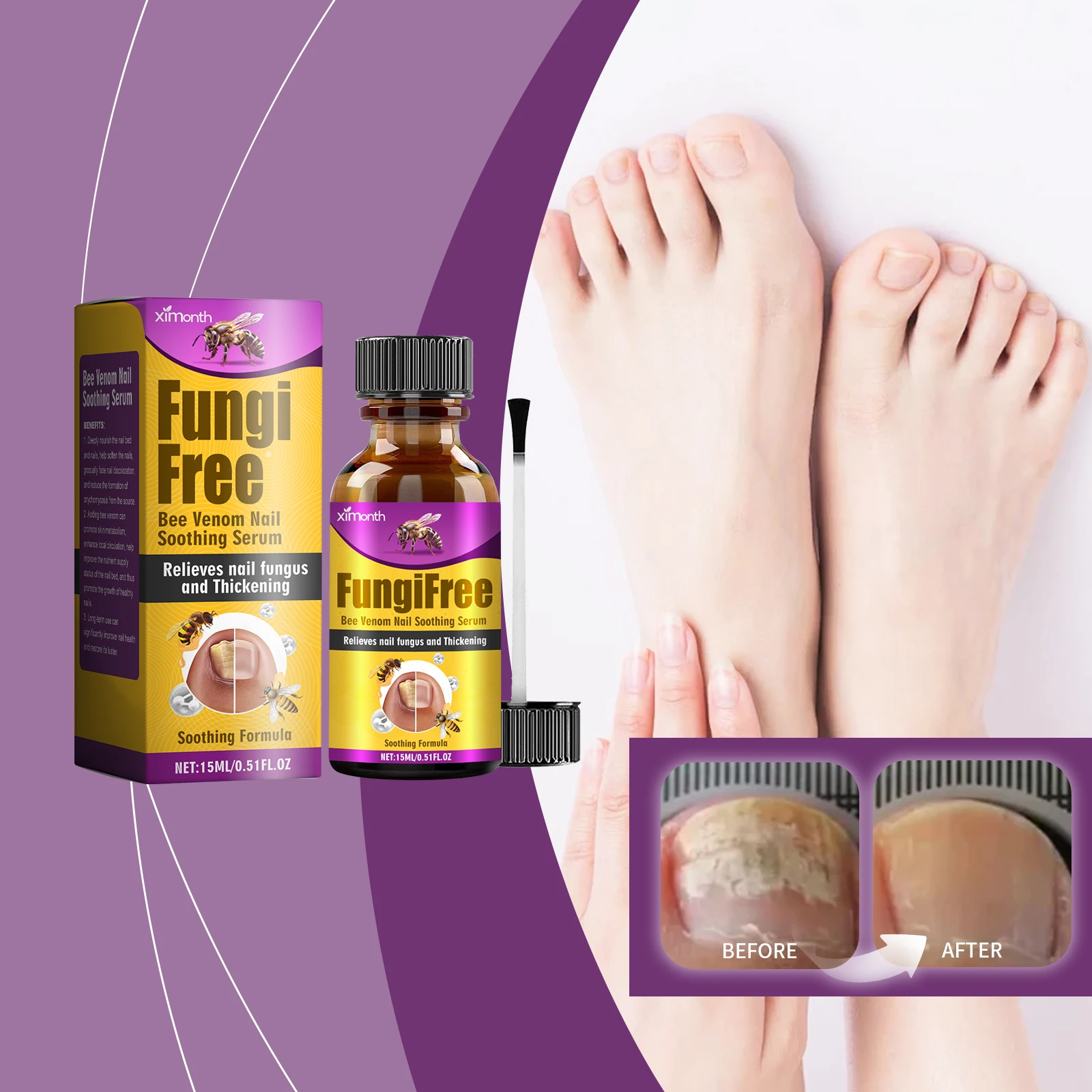 Solución para el cuidado de uñas gris con veneno de abeja, limpieza de uñas gris para manos y pies, reparación nutricional, espesamiento de uñas podridas y brillantes