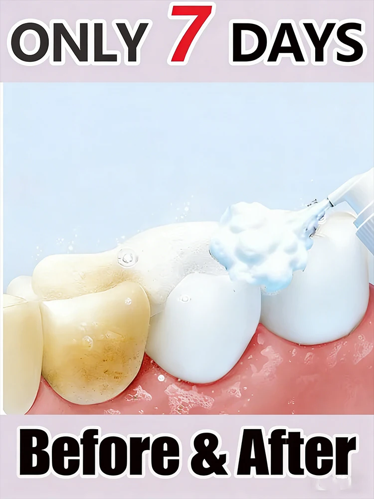 

2026 New upgrade 3.0 Intraoral Mousse clean tools,unisex,Free shipping