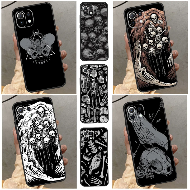 Skeleton  Bones Case For Xiaomi Mi 12T 11T Pro 13 11 12 Lite Cover For POCO X3 X5 Pro F5 M5 F3 F4 X4 GT