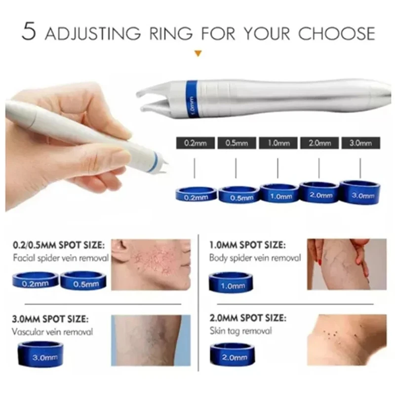 

Прямые поставки с завода: Лазерный диодный аппарат 5-в-1 (980 нм) для удаления сосудистых звездочек, лечения грибка ногтей, физиотерапии, омоложения кожи и ледяного компресса