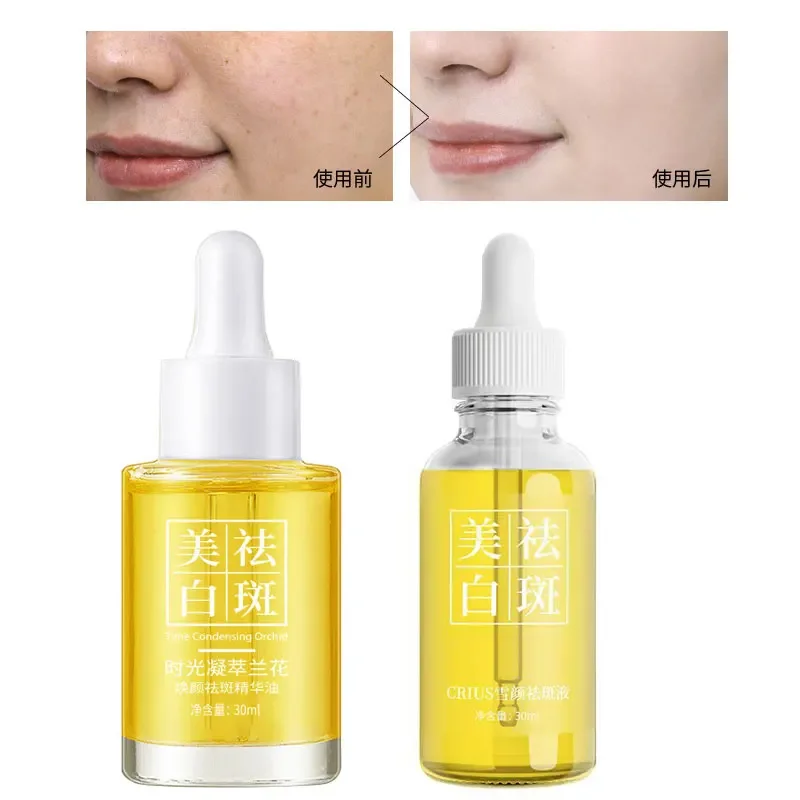 30ml Whitening and Freckle Removal Time Condensation Orchid Essence Oil Spot Dissolving Oil Moisturiz Moisturizing and Hydrating