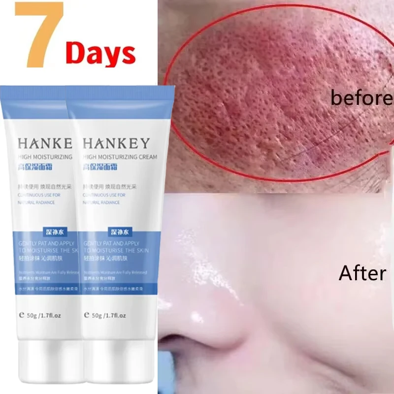 Facial Redness Repair Cream Sensitive Skin Dryness Moisturizer Hydrating Sooth Serum Lotion Removal Rosacea Skin Care Ointments