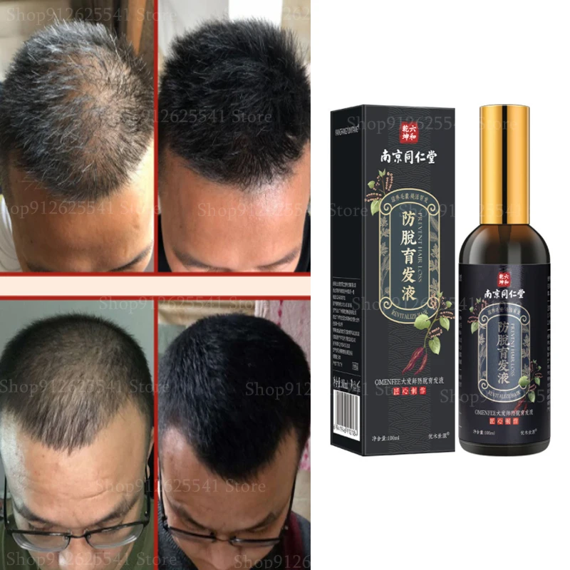 Aceite esencial para el crecimiento del cabello para adultos, productos de jengibre para evitar la caída del cabello, Serum denso con línea capilar, tratamiento rápido para prevenir el adelgazamiento del cabello