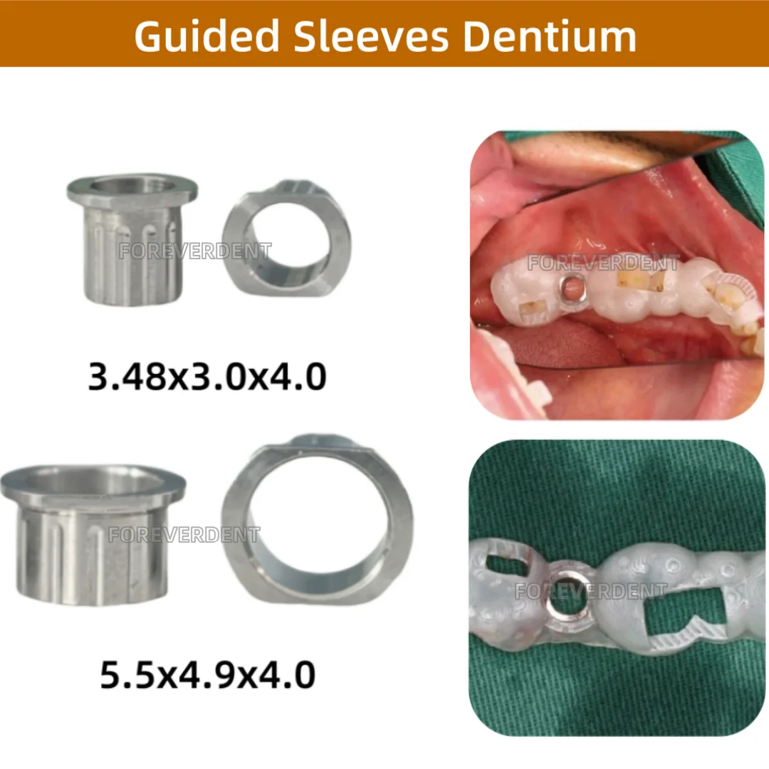 10 قطعة من الأكمام الموجهة الرقمية DIO للأسنان قالب تخطيط التصنيع الرقمي موضع الحفر 11 مقاسًا #3