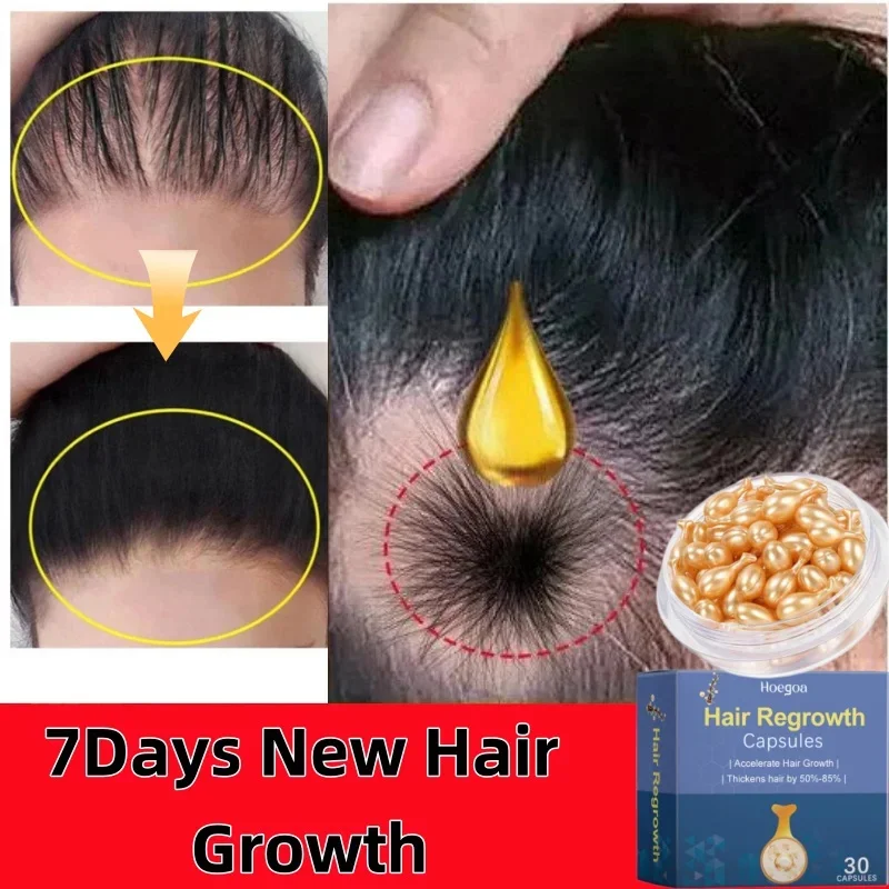 

Hair Growth Serum 7 Days Fast Regrowth Essential Capsule Anti Hair loss Baldness Repair Damaged Scalp Treatment For Women Men