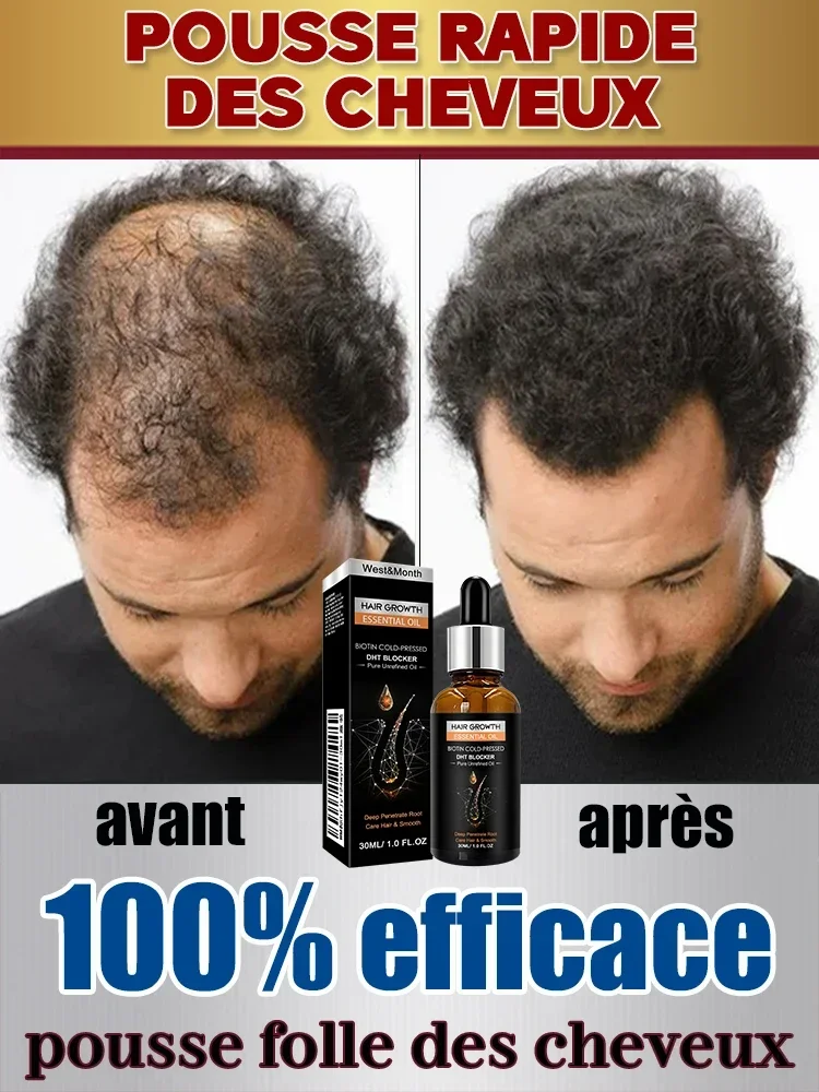 Hot selling product, 99% of buyers buy again, have more and more hair, say goodbye to baldness, thick hair