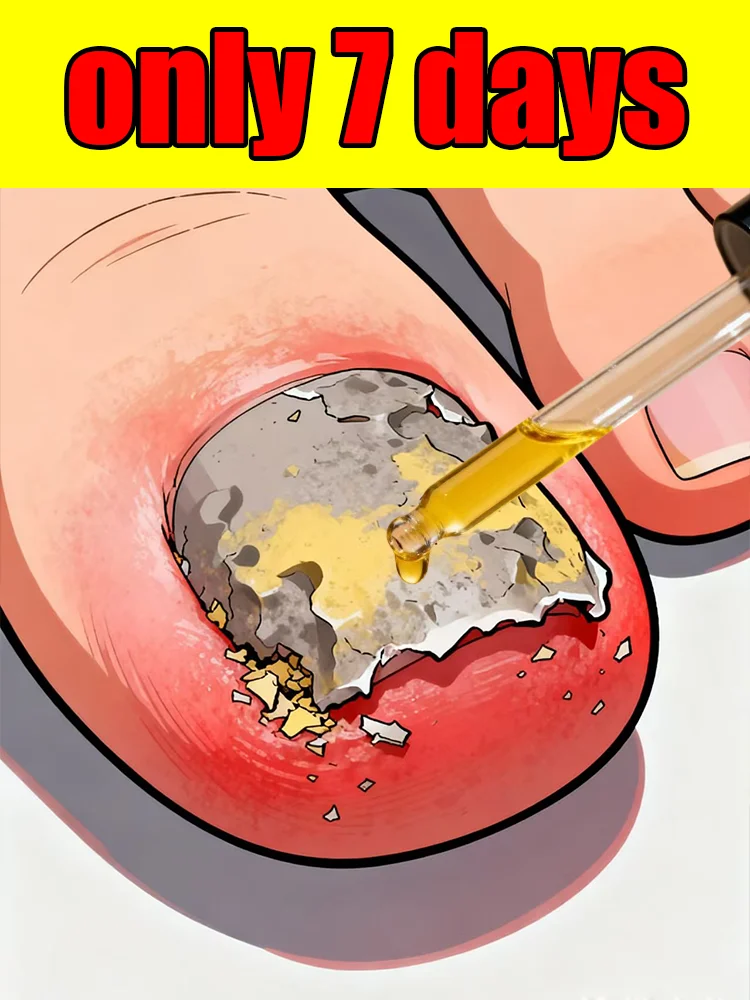 

A good product for cleaning nails and saying goodbye to nail damage