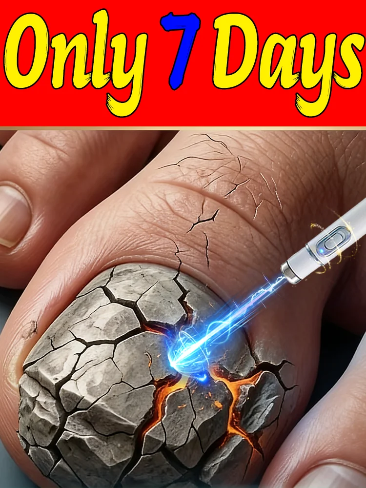 

blue light pen ʀᴇᴍᴏᴠᴇ ᴏɴʏᴄʜᴏᴍʏᴄᴏꜱɪꜱ Quickly restores shine and reduces worries.