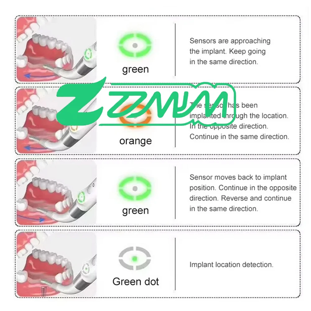 

Ден Тал Медицинский Локатор Интеллектуальный детектор пятен + 3 шт. 360 ° Датчик распыления