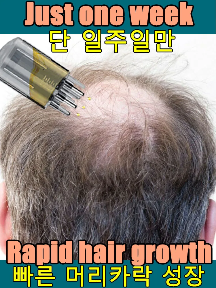 100% revive cabelo, penetração forte, atire as raízes do cabelo, mais cabelo, diga adeus à calvície, cabelos grossos