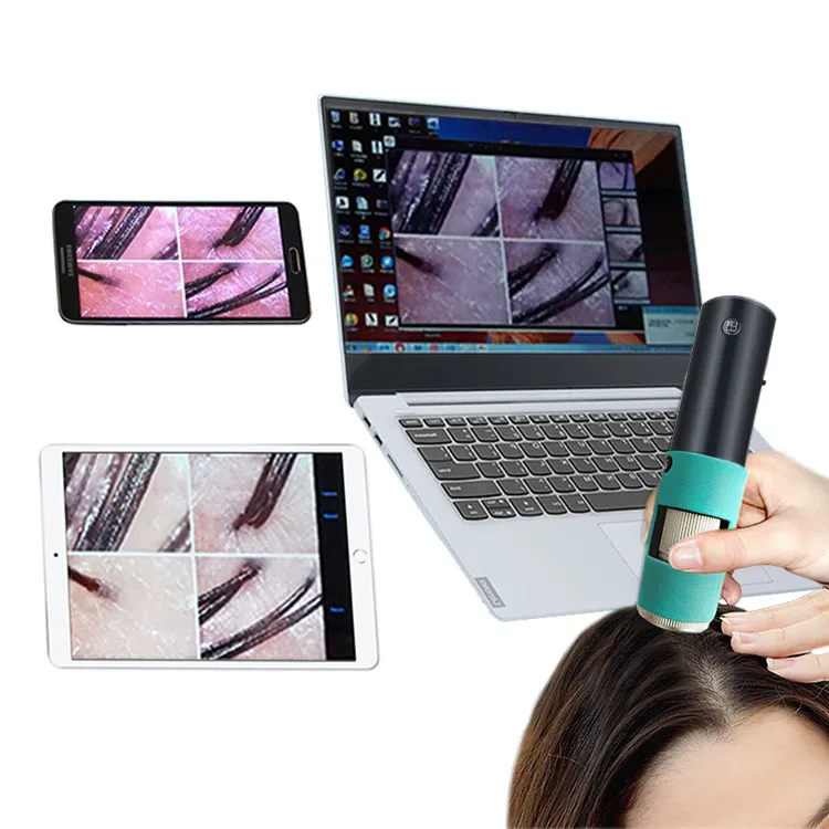 Portable facial cosmetic tool digital  moisture analyzer  analyzer for Detect  Moisture for home