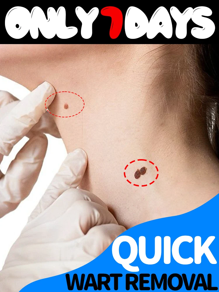 

[2025 Патент] Точное удаление бородавок, формирование кожи