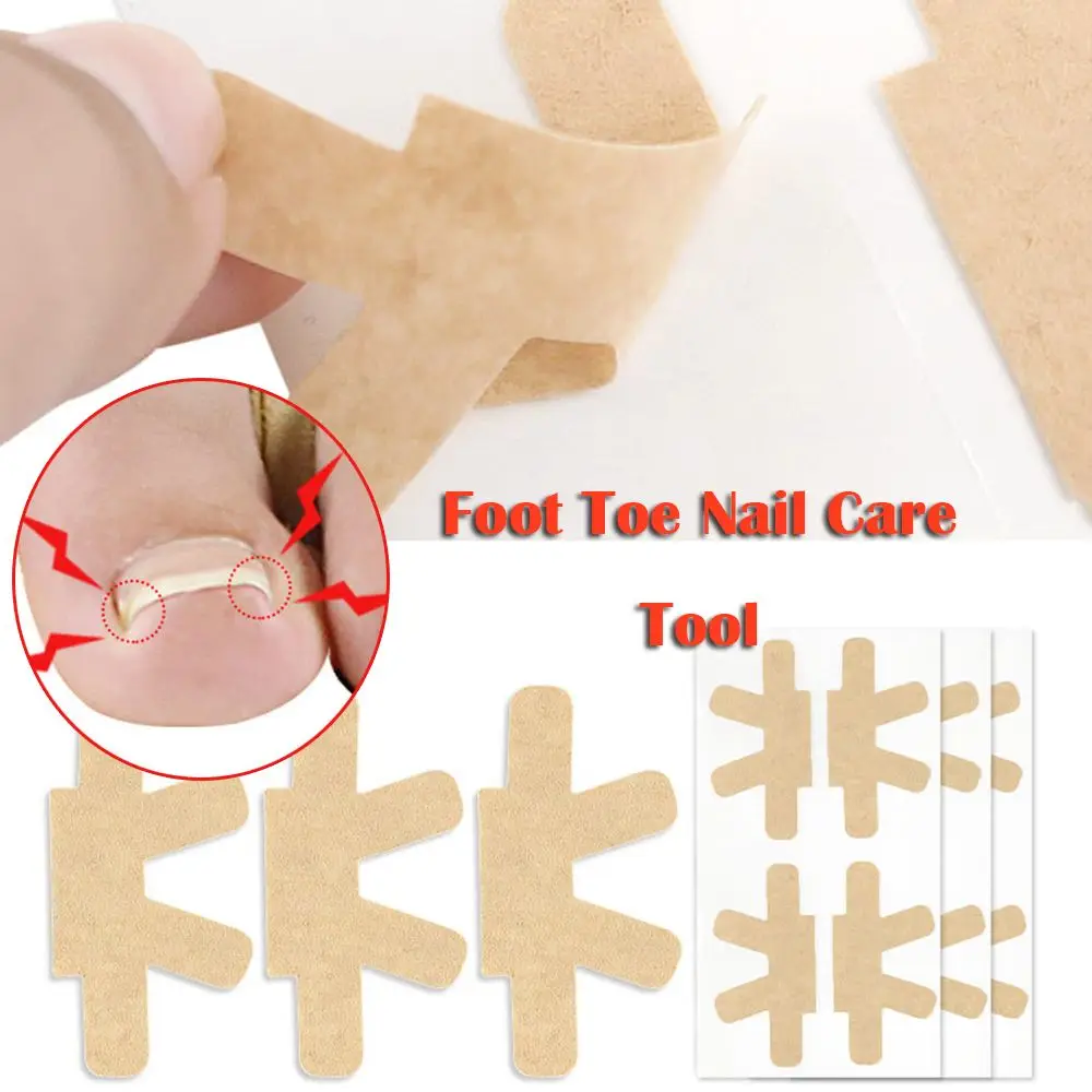 Paronychia Treatment Fixer Nail Care Patch Pedicure Tools Toenail Treatment Corrector Stickers adesivi per unghie incarnite