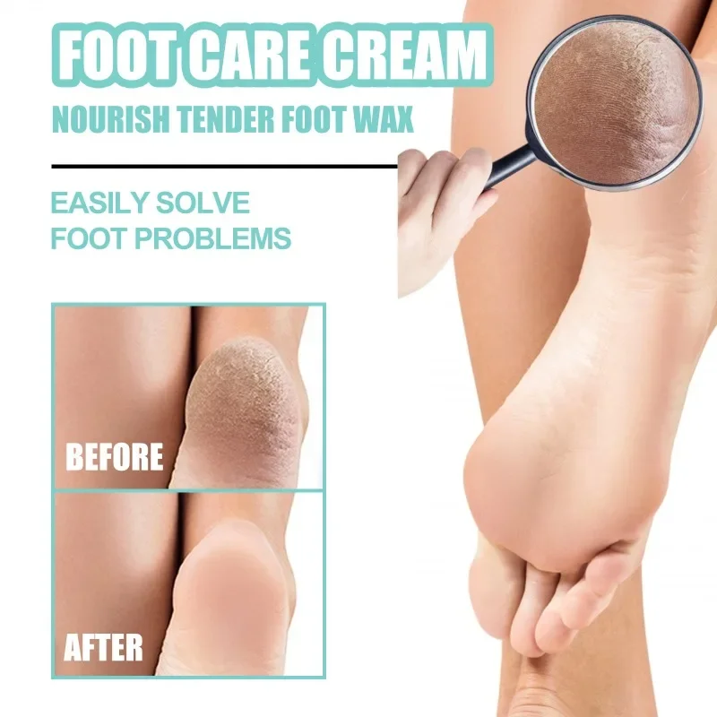 Sdotter New Foot Cream Repair Dry Peeling Cracks Heels removal Callus Dead Skin Anti chapped exfoliation Moisturizing hydrating