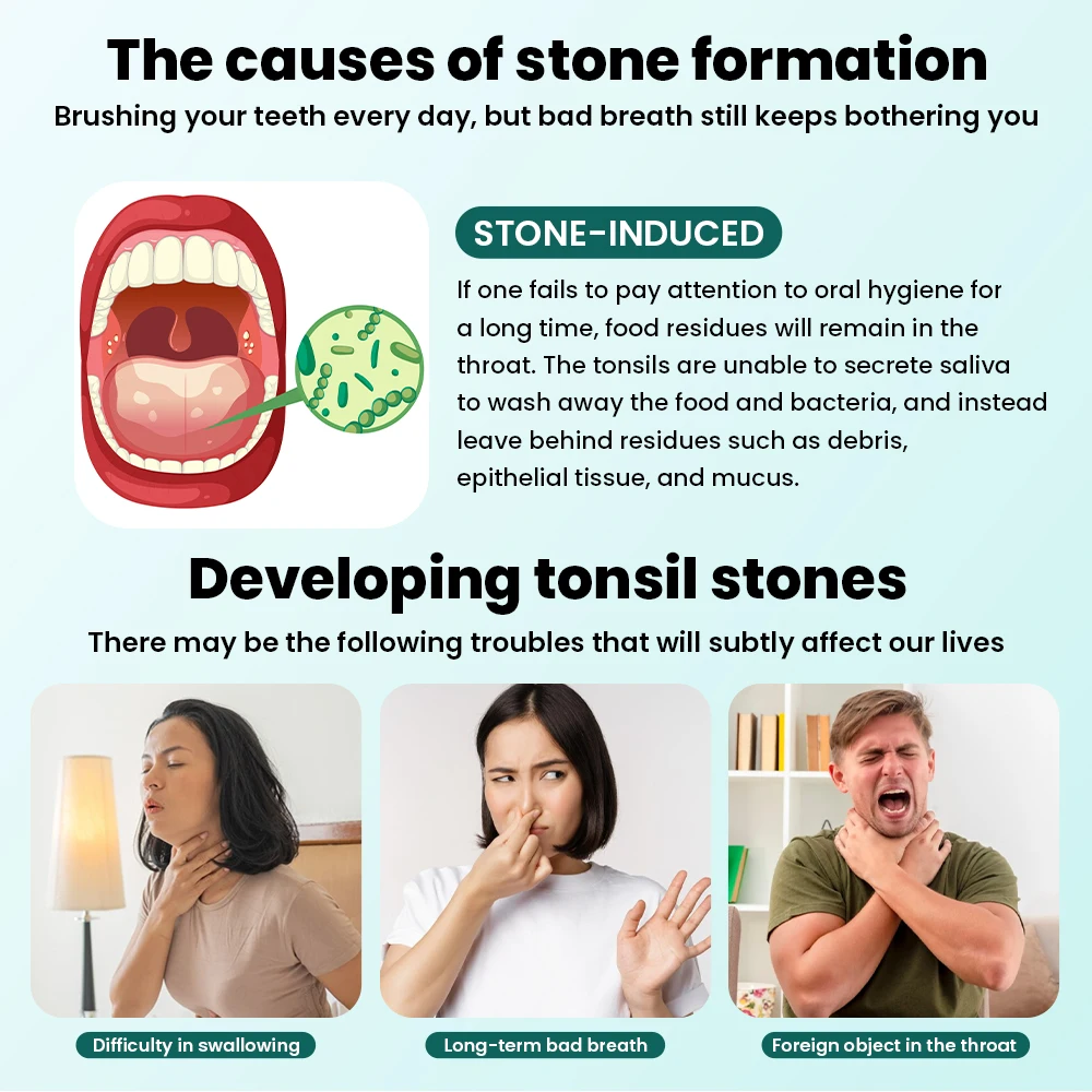 Electric Vacuum Tonsil Stone Remover with LED Light & 8 Suction Modes Bad Breath Relief & Tongue Cleaner